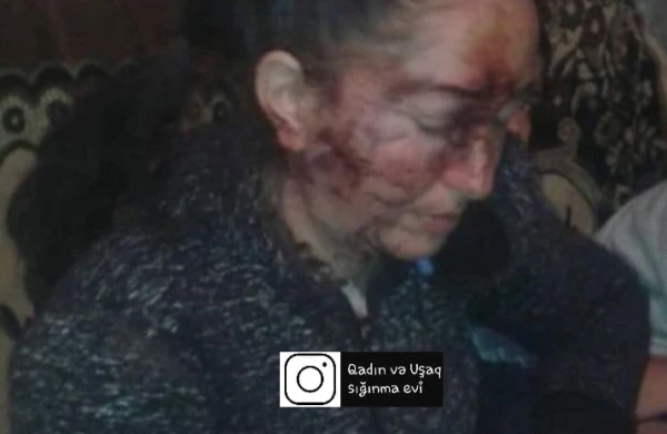 Şəmkirdə ər arvadını içki şüşəsi ilə vəhşicəsinə döydü - FOTO