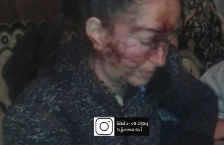 Şəmkirdə ər arvadını yatdığı yerdə vəhşicəsinə döydü - FOTO