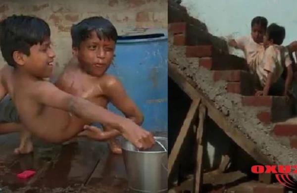 Bədənləri birləşik,başları ayrı: Siyam əkizləri necə doğulur?+VİDEO