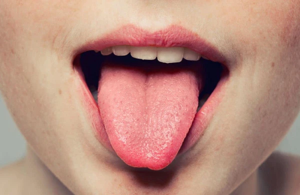 Dil nə zaman qanayır? - Təhlükəli xəstəliklərin əlaməti