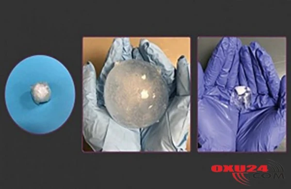 Bir ay ərzində mədəni izləyə bilən həb hazırlanıb