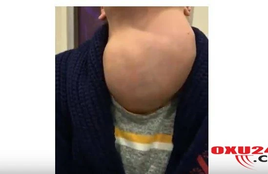 Xəstənin zobu həkimi də dəhşətə saldı