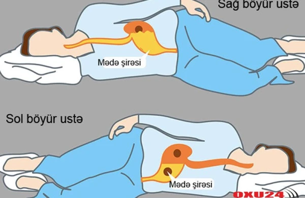 Nə üçün sol böyür üstə yatmaq lazımdır?