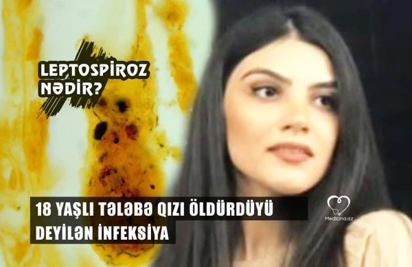 BDU-nun  tələbəsini  öldürdüyü deyilən infeksiya: