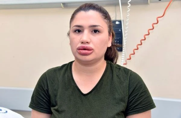 Həbsdə  olan   plastik cərrah  həbsxanadan  qaçıb