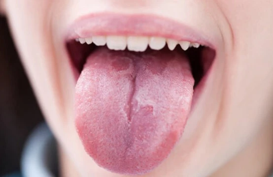 Dil nə zaman qanayır?