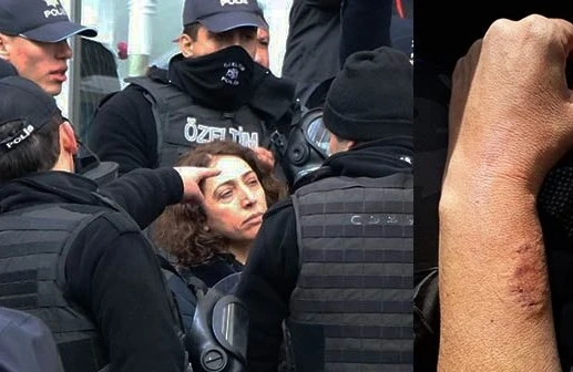 Şok görüntü! Qadın millət vəkili polisin qolunu dişlədi