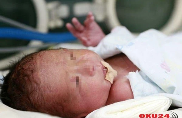 Anadan qızına uşaqlıq köçürüldü, hamiləlik baş tutdu - Dünyada 14-cü körpə