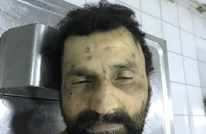 Nazirlik Bu Şəxslə Bağlı Əhaliyə Müraciət Etdi – FOTO