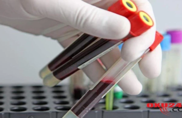 Danimarka alimləri xərçəngi məhv etməyin yeni üsulunu elan etdilər