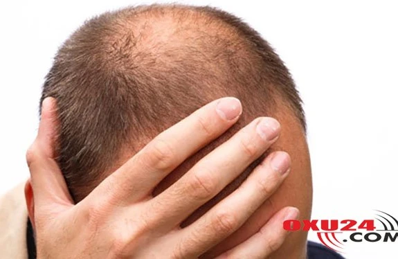 Saçı tökülənlər MÜTLƏQ OXUSUN — 3 MÜKƏMMƏL RESEPT Cəmiyyət