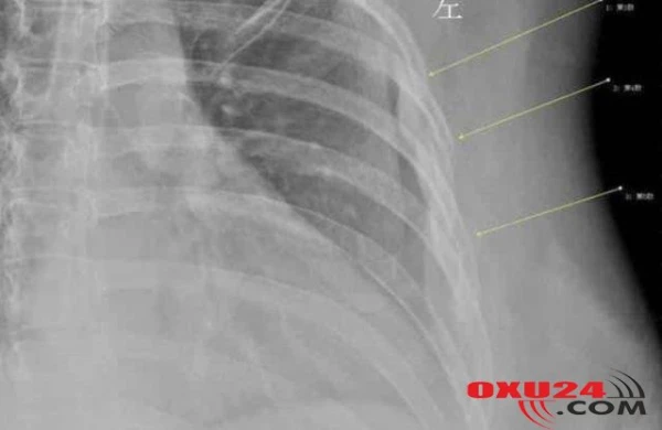 3 yaşlı qızları gəlin kimi satırlar - TÜKÜRPƏDƏN SƏBƏB