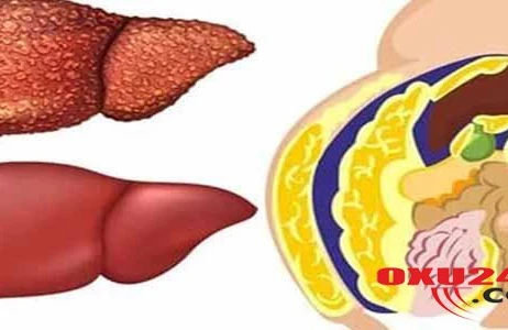 Hər evdə olan bu adi 3 məhsul qaraciyəri xəstəliklərdən qoruyur