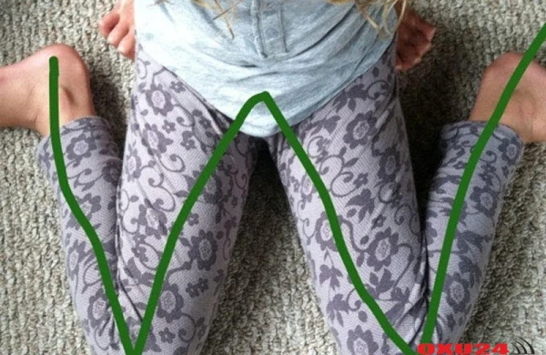 “W” şəklində oturmaq nədir?