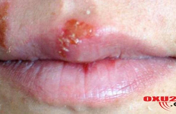 Diyetoloqlar dünyanın ən faydalı 10 məhsulunu təyin ediblər