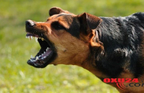 Gənc oğlan it tutmasından öldü: “Diaqnozunu biz də dəqiqləşdirə bilmədik” – Baş həkim