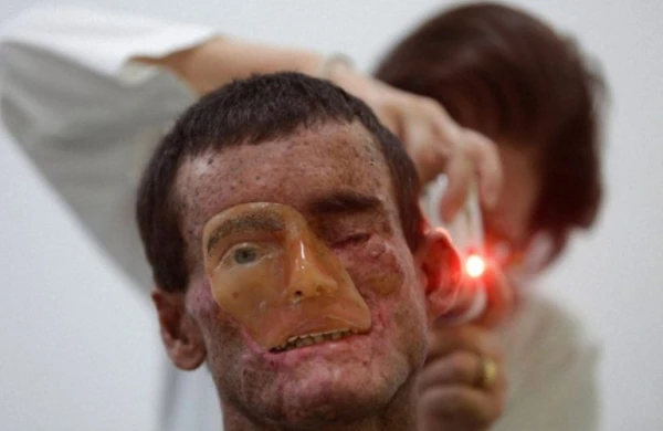 Bu qəsəbənin sakinlərini gün işığı əridir - Dəhşətli görüntülər