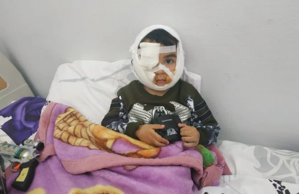 “İt Hüseynin üzündən yapışaraq bir neçə metr sürüyüb” -ŞOK təfərrüat