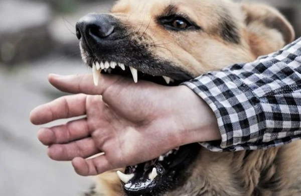 Azərbaycanda iki nəfər it dişləməsindən ölüb: Günah özlərindədir