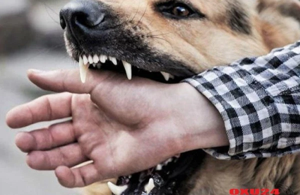 Sonu ölüm olan QUDUZLUQ - Əlamətləri, müalicəsi, yardım