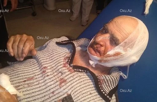 Lənkəranda dəhşət:Itlər bir gecədə  9 nəfəri parçaladı