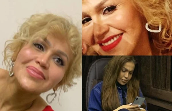 Rəqsanə niyə bu hala qalıb? - Fotolar