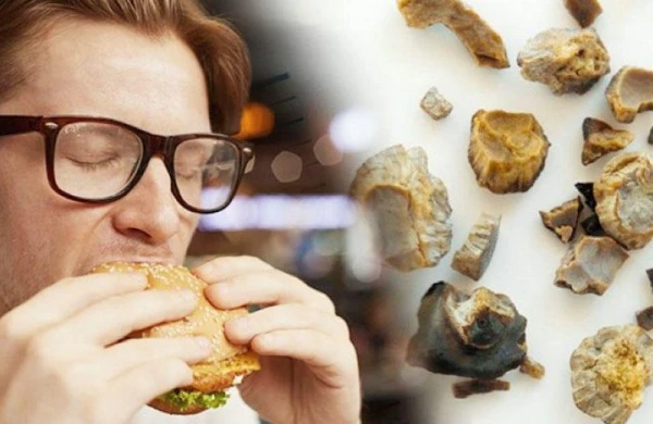 Bu qidalar böyrək daşı yaradır - SİYAHI