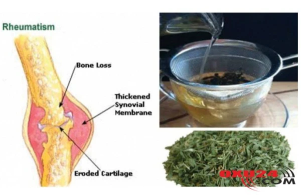 Bu xalq təbabəti vasitəsilə revmatizma birdəfəlik yoxa çıxacaq!