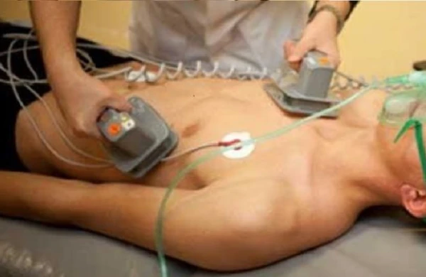 Ölən adama 5 min volt ELEKTRİK verdilər - Nəticə hamını ŞOKA SALDI