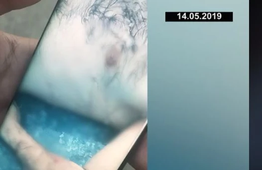 Bakıda 80 bıçaqla öldürülən kriminal avtoritetin meyitinin  DƏHŞƏTLİ  GÖRÜNTÜSÜ