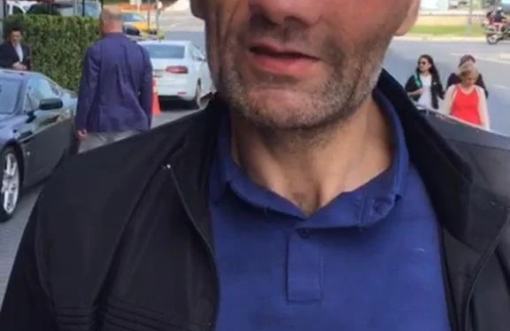 Üzündə nəhəng şiş yaranmış kişini Türkiyədə belə müalicə edirlər – Həkimindən Açıqlama