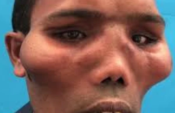 Aslan sifət oğlan dəyişib bu hala düşdü, heç kim tanımadı