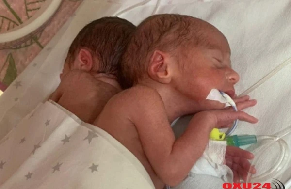 Bakıda dördəm dünyaya gəlib - FOTO