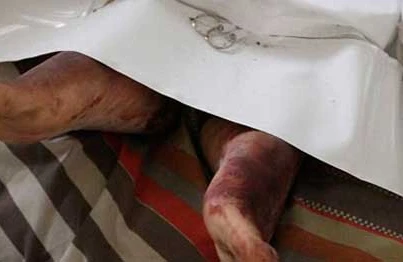 Bakıda DƏHŞƏT: Ər xəyanətə görə arvadının başını kəsib, 4-cü mərtəbədən atdı