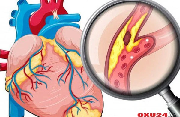 Damar tıxanmasından bizi qoruya biləcək 7 məhsul 