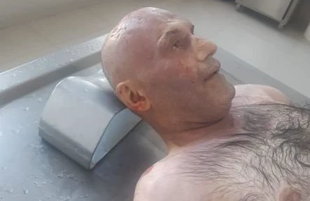 Bu meyiti tanıyanlar polisə xəbər etsin - FOTO