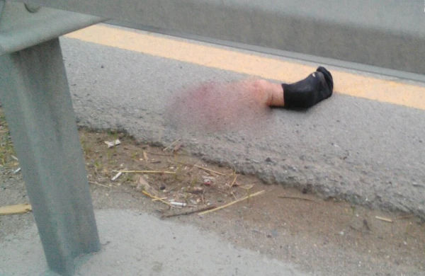 Bakıda maşın vuran piyadanın ayağı qopdu - şok görüntülər