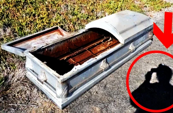 Tibb dünyası şokda: Morqa gətirilən meyit bədəninə bıçaq dəyən anda dirildi