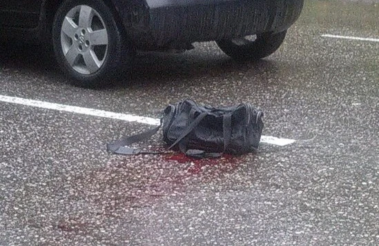 Gəncədə avtobus 2 yaşlı uşağın ayaqlarının üzərindən keçib