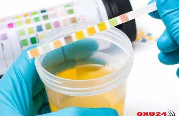 Flora Kərimovanın sidik qəbuluna tanınmış həkimdən ŞOK REAKSİYA - İnanılmaz FAKTLAR