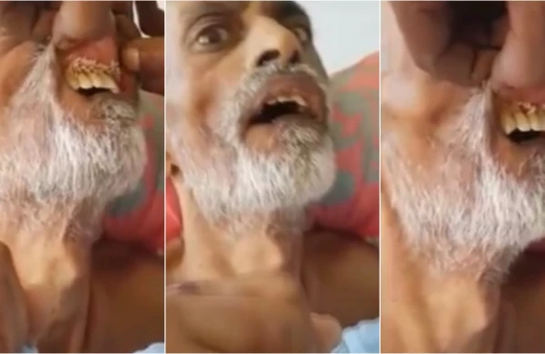 ŞOK görüntü: Dəhşətli xəstəlik yayılıb, qurdlar insanı belə yeyir