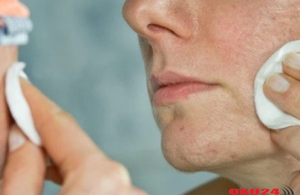 Sızanaqlardan xilas olmağın yolu - RESEPT