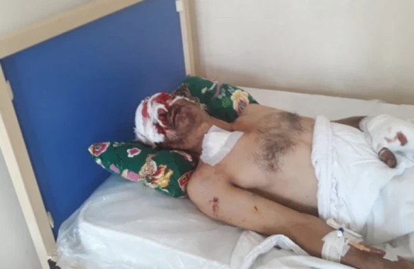 "Kamaz" təkəri partladı, ustanın gözü çıxdı - Ağstafada bədbəxt hadisə