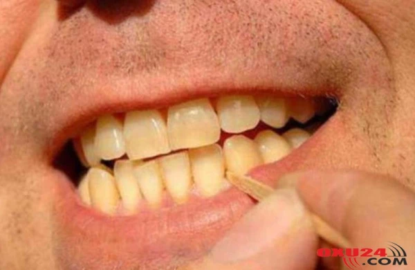 Stomatoloqdan diş çöpü XƏBƏRDARLIĞI