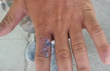 Fərarilik etmiş erməni hərbçisi təmas xəttində saxlanıldı - FOTO