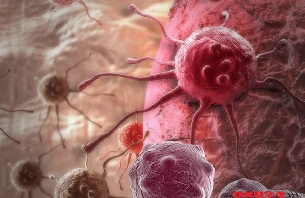 Bu insanlara XƏBƏRDARLIQ: Xərçəng riskini azı iki dəfə artırır