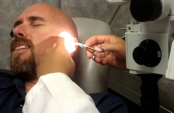 DƏHŞƏTLİ HADİSƏ: Huşsuz vəziyyətdə tapıldı,həkimə gedəndə qulağından görün nə çıxdı