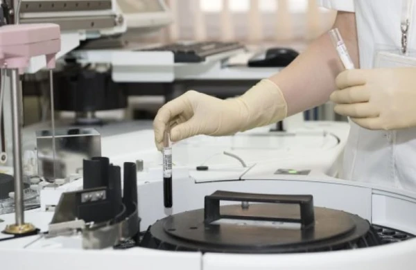 Rusiyaya gələn dəhşətli təhlükə Azərbaycana keçə bilərmi?