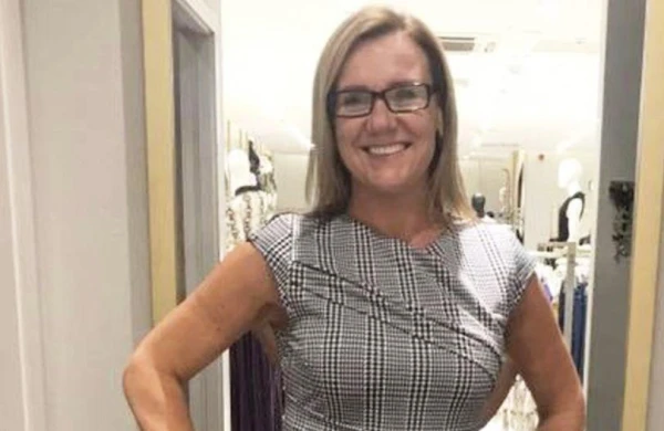 Sinə və piyçəkmə əməliyyatına 8000 manat ödəyən qadın eybəcər hala düşdü - FOTO