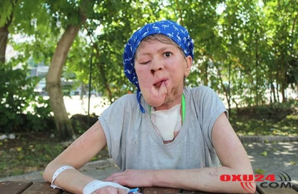 Bir sızanaq həyatını məhv etdi - Foto